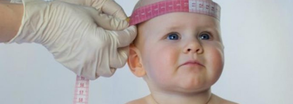 Casos de microcefalia aumentam 70% em uma semana no Brasil