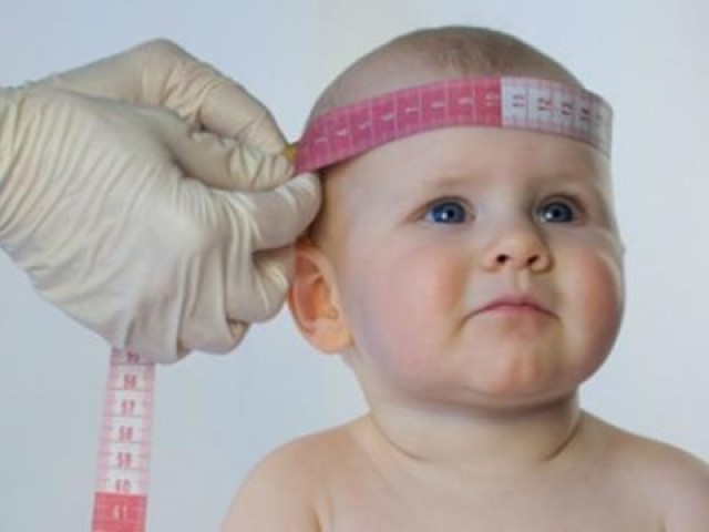 Casos de microcefalia aumentam 70% em uma semana no Brasil